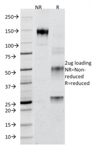 SDS-PAGE Analysis of Purified Adipophilin Mouse Monoclonal Antibody (ADFP/1365). Confirmation of Purity and Integrity of Antibody.