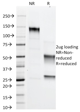 SDS-PAGE Analysis of Purified Adipophilin Mouse Monoclonal Antibody (ADFP/1366). Confirmation of Integrity and Purity of Antibody.