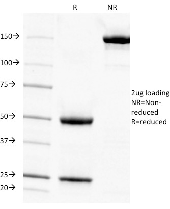 SDS-PAGE Analysis  Purified Adipophilin Mouse Monoclonal Antibody (ADFP/1494). Confirmation of Integrity and Purity of Antibody.