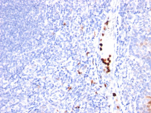 Granulocyte-Colony Stimulating Factor (G-CSF) Antibody