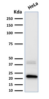 Ferritin, Light Chain (Node-Negative Breast Tumor Prognostic Marker) Antibody