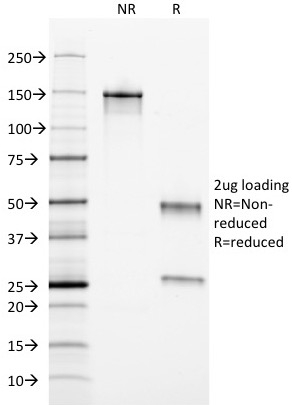 Ferritin, Light Chain (Node-Negative Breast Tumor Prognostic Marker) Antibody - Image 2