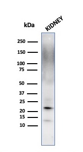 Ferritin, Light Chain (Node-Negative Breast Tumor Prognostic Marker) Antibody - Image 4