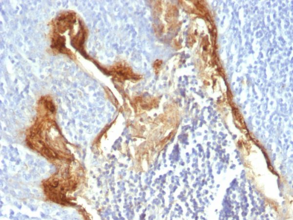 Involucrin (Squamous Cell Terminal Differentiation Marker) Antibody