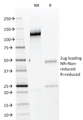 SDS-PAGE Analysis of Purified NKX2.2 Mouse Monoclonal Antibody (NX2/294).