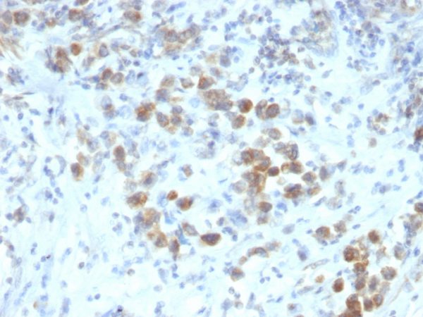 PAX6 (Stem Cell Marker) Antibody