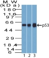 p53 Tumor Suppressor Protein Antibody - Image 3