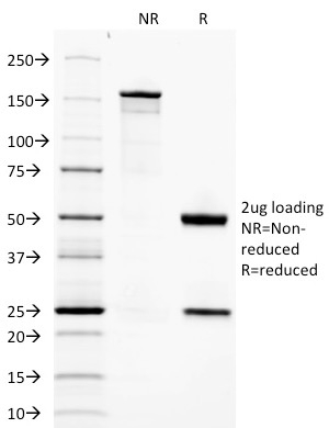SDS-PAGE Analysis of Purified Adiponectin Mouse Monoclonal Antibody (ADPN/1370). Confirmation of Integrity and Purity of Antibody.
