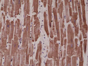 Immunohistochemical