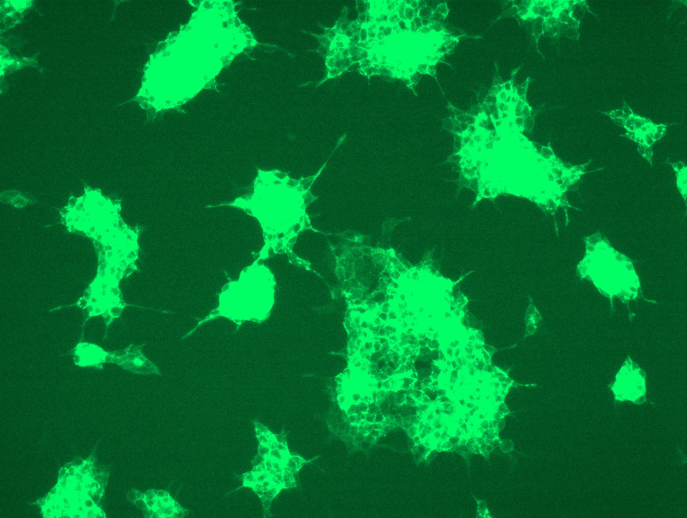 Claudin18 (CLDN18) (NM_001002026) Human Tagged ORF Clone Lentiviral Particle