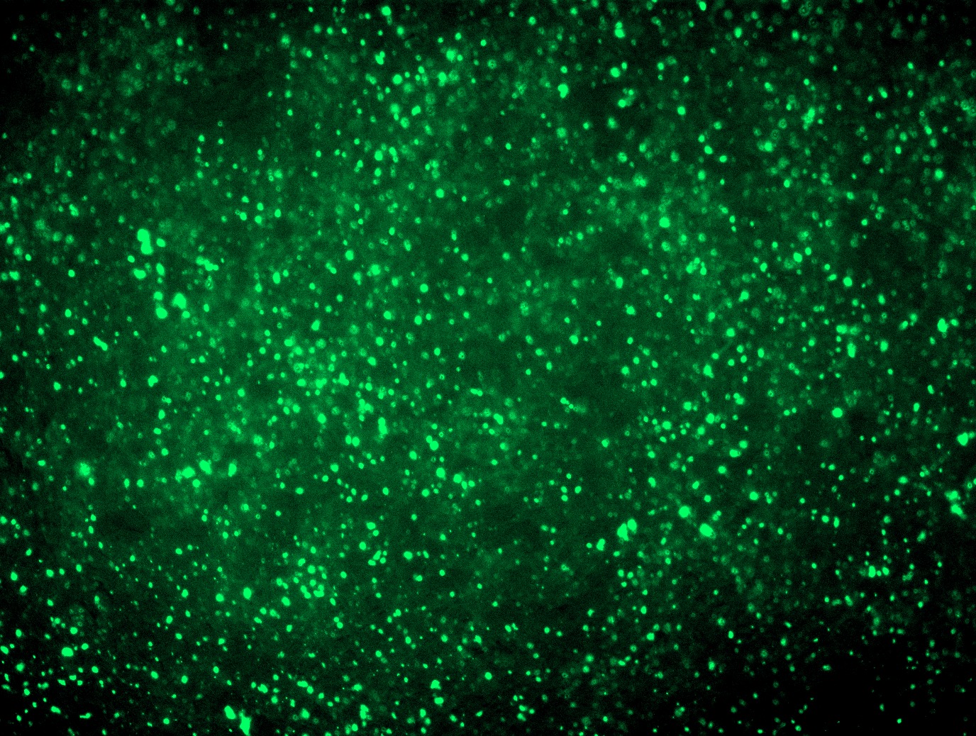 TNFAIP3 (NM_006290) Human Tagged ORF Clone Lentiviral Particle