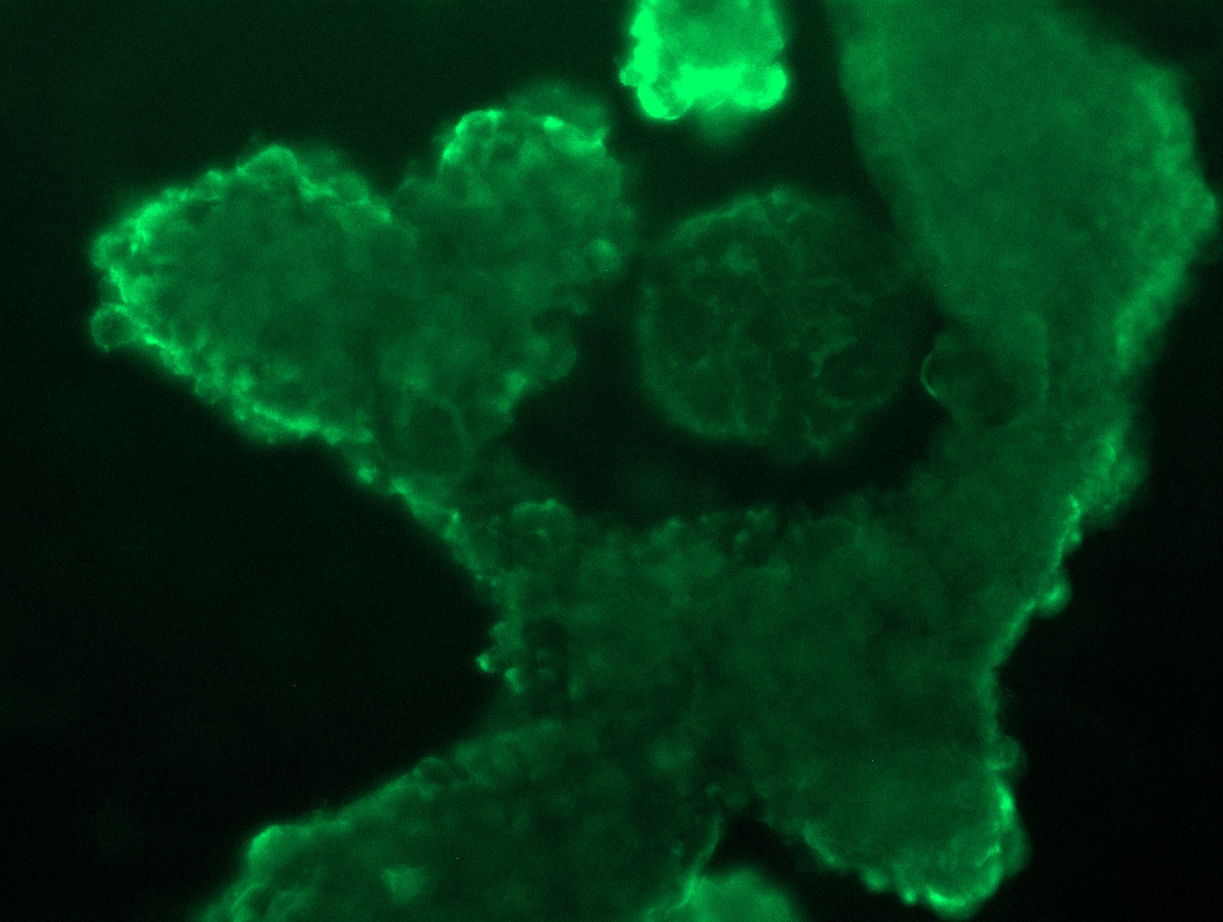 Claudin18 (CLDN18) (NM_001002026) Human Tagged ORF Clone Lentiviral Particle