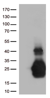 MelanA (MLANA) Mouse Monoclonal Antibody [Clone ID: OTI3E2]