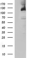 PMS2 Mouse Monoclonal Antibody (Biotin conjugated) [Clone ID: OTI2G5]