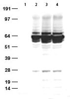 Rabbit monoclonal anti-HA tag Antibody, clone OTIR7C9