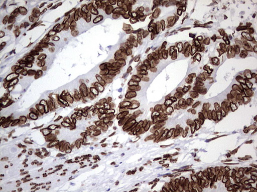 bcl 6 (BCL6) Mouse Monoclonal Antibody (Biotin conjugated) [Clone ID: OTI1C3]