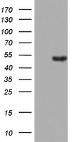 LKB1 (STK11) Mouse Monoclonal Antibody [Clone ID: OTI10A3]