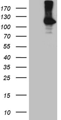 ROR2 Mouse Monoclonal Antibody [Clone ID: OTI4B10]