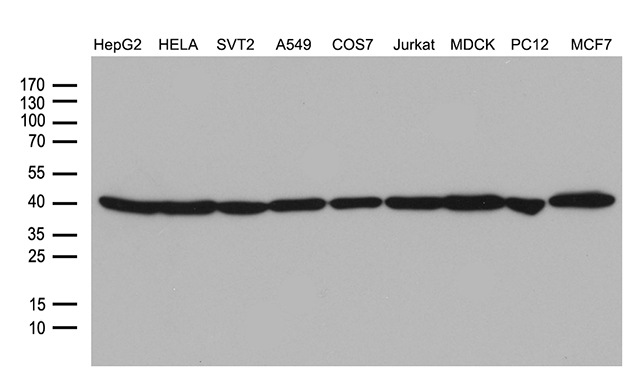 beta Actin (ACTB) Mouse Monoclonal Antibody [Clone ID: OTI1]