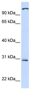 TLR2 Rabbit Polyclonal Antibody