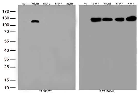 ROR1 Mouse Monoclonal Antibody [Clone ID: OTI3D11]