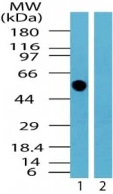 TRK fused gene (TFG) Rabbit Polyclonal Antibody