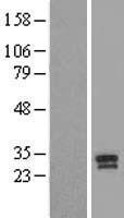 Prostate Specific Antigen (KLK3) (NM_001648) Human Over-expression Lysate