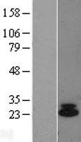 IL6 (NM_000600) Human Over-expression Lysate