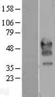 PD1 (PDCD1) (NM_005018) Human Over-expression Lysate