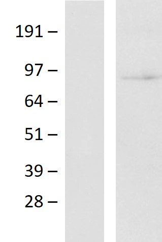 B Raf (BRAF) (NM_004333) Human Over-expression Lysate