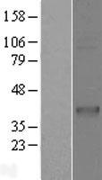 CD1C (NM_001765) Human Over-expression Lysate