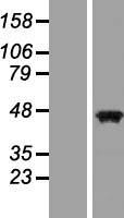 PAX5 (NM_016734) Human Over-expression Lysate