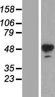 Tyrosine Hydroxylase (TH) (NM_000360) Human Over-expression Lysate