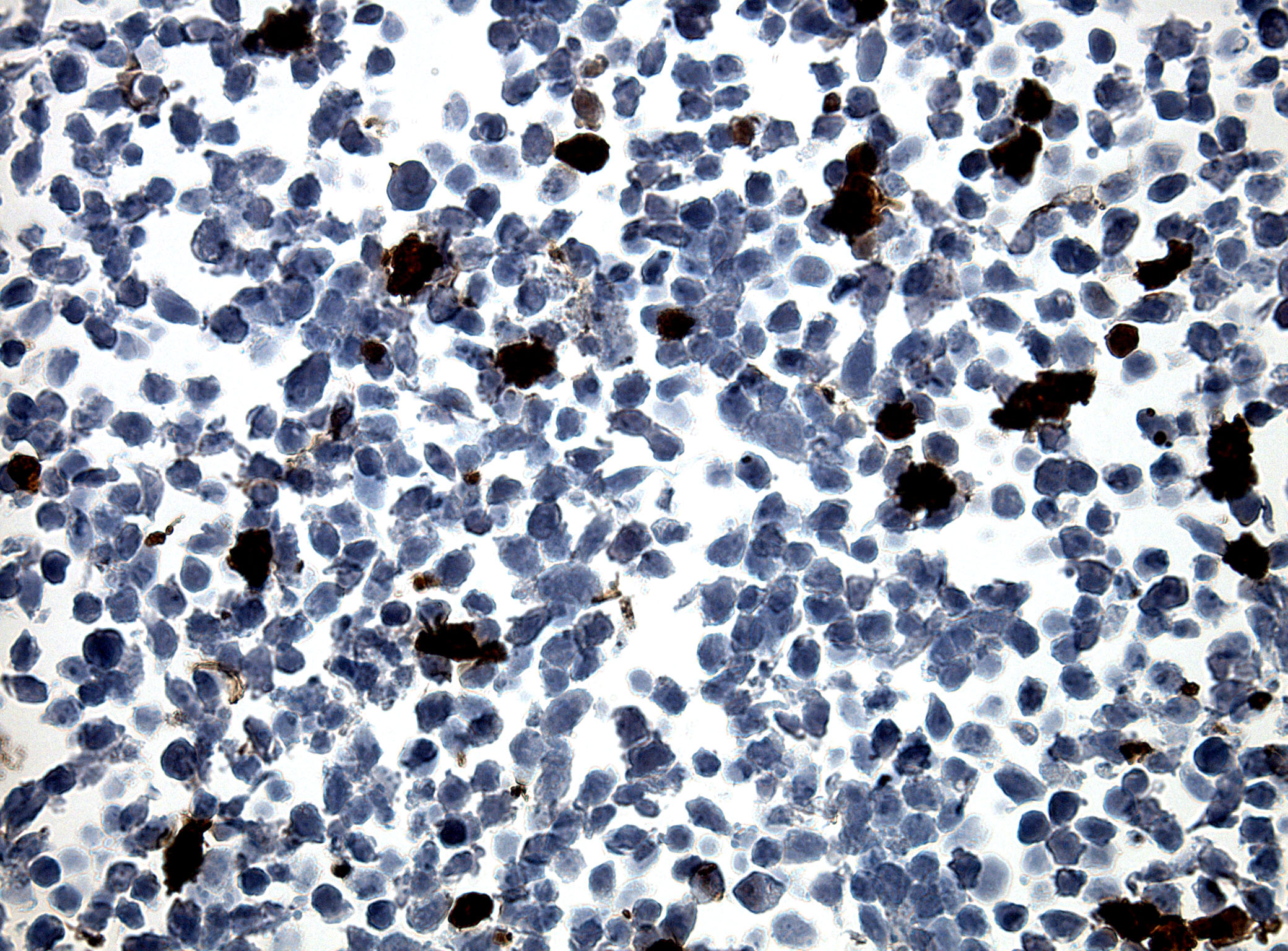 Myc-DDK-tGFP CytoSection