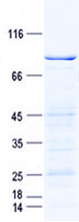 LKB1 (STK11) (NM_000455) Human Recombinant Protein