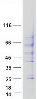 TGF beta Receptor II (TGFBR2) (NM_003242) Human Recombinant Protein