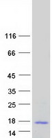 Keratinocyte differentiation associated protein (KRTDAP) (NM_207392) Human Recombinant Protein