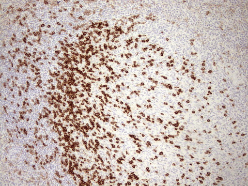 PD1 (PDCD1) Mouse Monoclonal Antibody [Clone ID: UMAB199]