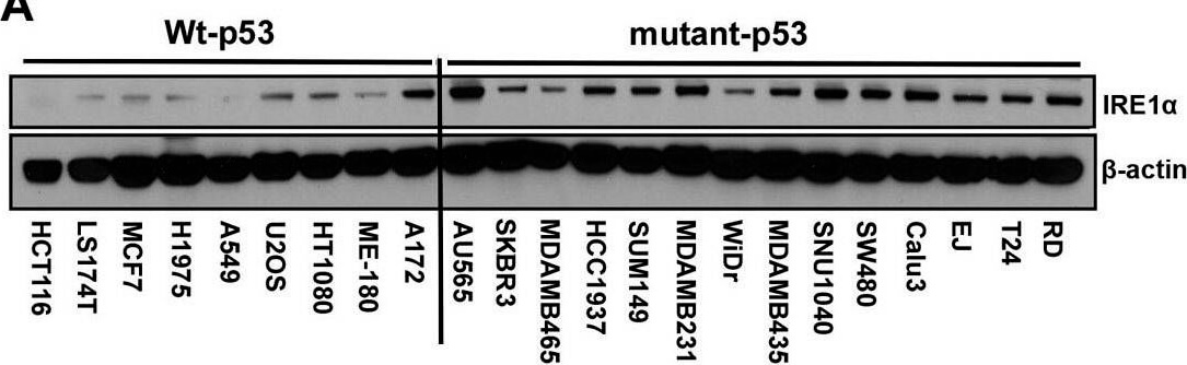 Western Blot using Mouse TrueBlot® ULTRA: Anti-Mouse Ig HRP