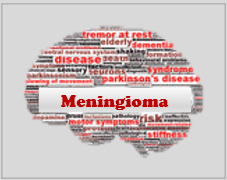 Meningioma