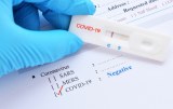 SARS-CoV-2 - Schnelltests für Forschung und Entwicklung